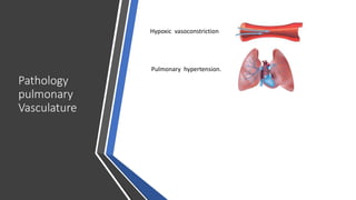Pathology
pulmonary
Vasculature
Pulmonary hypertension.
Hypoxic vasoconstriction
 