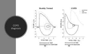 COPD
diagnosis
 