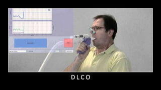 D L C O
 