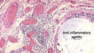 Anti inflammatory
agents
 