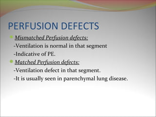 PERFUSION DEFECTS 
Mismatched Perfusion defects: 
-Ventilation is normal in that segment 
-Indicative of PE. 
Matched Perfusion defects: 
-Ventilation defect in that segment. 
-It is usually seen in parenchymal lung disease. 
 