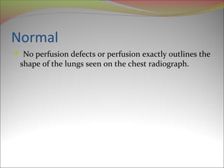 Normal 
 No perfusion defects or perfusion exactly outlines the 
shape of the lungs seen on the chest radiograph. 
 