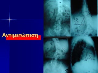 Αντιμετώπιση
 