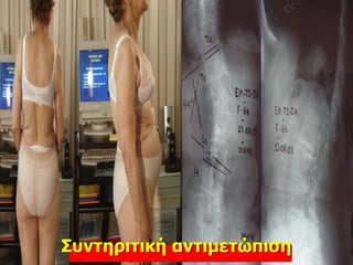 Συντηριτική αντιμετώπιση
 