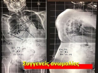 Συγγενείς ανωμαλίες
 