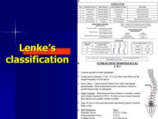 Lenke’s
classification
 