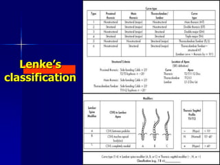 Lenke’s
classification
 