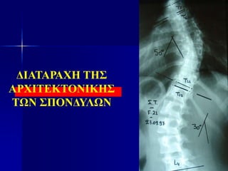 ΔΙΑΤΑΡΑΧΗ ΤΗΣ
ΑΡΧΙΤΕΚΤΟΝΙΚΗΣ
ΤΩΝ ΣΠΟΝΔΥΛΩΝ
 