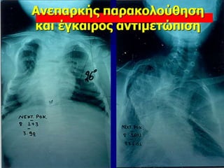 Ανεπαρκής παρακολούθηση
και έγκαιρος αντιμετώπιση
 