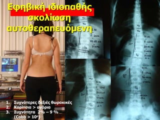 1. Συχνότερες δεξιές θωρακικές
2. Κορίτσια > αγόρια
3. Συχνότητα 2% – 9 %
(Cobb > 10o)
Εφηβική ιδιοπαθής
σκολίωση
αυτοθεραπευόμενη
 