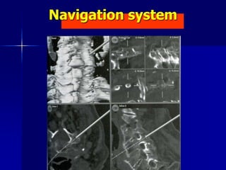 Navigation system
 