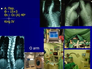  Α. Παρ.
Θ – 15+3
Θ5 – Ο2 (Α) 40ο
King IV
O arm
 