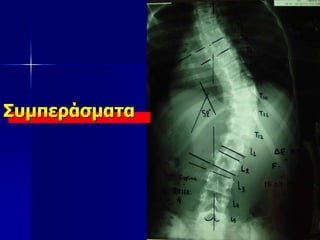 Συμπεράσματα
 