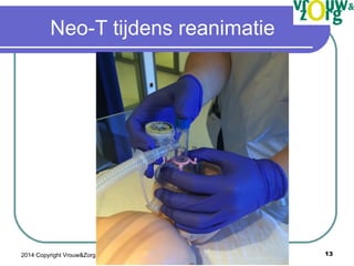 Neotee Usage Guide.pdf NEOTEE Reanimatie Vrouwenzorg NLS / NEOTEE resuscitation NLS / NEOTEE ...