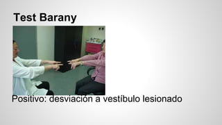 Test Barany
Positivo: desviación a vestíbulo lesionado
 