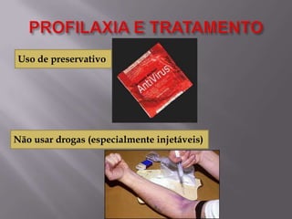 Uso de preservativo

Não usar drogas (especialmente injetáveis)

 