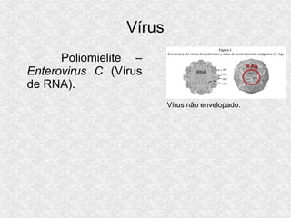 Vírus
Poliomielite –
Enterovirus C (Vírus
de RNA).
Vírus não envelopado.
 