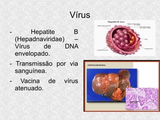 Vírus
- Hepatite B
(Hepadnaviridae) –
Vírus de DNA
envelopado.
- Transmissão por via
sanguínea.
- Vacina de vírus
atenuado.
 