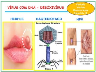 VÍRUS COM DNA - DESOXIVÍRUS
HERPES BACTERIOFAGO HPV
Aciclovir
Varicela
Variola
Mononucleose
Hepatite B
 