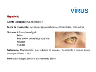 VÍRUS
 