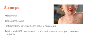 Sarampo
Morbillivirus
Transmissão: saliva
Sintomas: lesões avermelhadas, febre e conjuntivite;
Tríplice viral MMR : vacina de vírus atenuados, contra sarampo, caxumba e
rubéola.
 