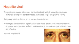 Hepatite viral
Transmissão: água e alimentos contaminados (HAV); transfusão, seringas,
materiais cirúrgicos contaminados ou fluídos corporais (HBV e HCV);
Sintomas: icterícia, febre, urina escura, fezes claras;
Prevenção: saneamento, higienização das mãos e sanitários, tratamento dos
doentes, seringas descartáveis, preservativos, testar o sangue utilizado nas
transfusões;
Vacina: Hepatite B.
 