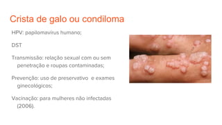 Crista de galo ou condiloma
HPV: papilomavírus humano;
DST
Transmissão: relação sexual com ou sem
penetração e roupas contaminadas;
Prevenção: uso de preservativo e exames
ginecológicos;
Vacinação: para mulheres não infectadas
(2006).
 