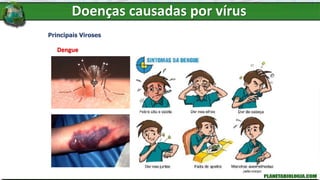 Doenças causadas por vírus
Principais Viroses
Dengue
 
