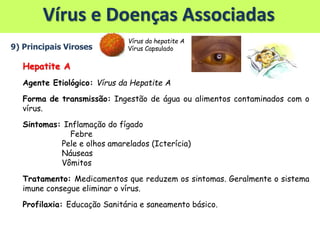 Vírus e Doenças Associadas
9) Principais Viroses
Hepatite A
Agente Etiológico: Vírus da Hepatite A
Forma de transmissão: Ingestão de água ou alimentos contaminados com o
vírus.
Sintomas: Inflamação do fígado
Febre
Pele e olhos amarelados (Icterícia)
Náuseas
Vômitos
Tratamento: Medicamentos que reduzem os sintomas. Geralmente o sistema
imune consegue eliminar o vírus.
Profilaxia: Educação Sanitária e saneamento básico.
Vírus da hepatite A
Vírus Capsulado
 