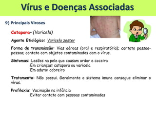 Vírus e Doenças Associadas
9) Principais Viroses
Catapora– (Varicela)
Agente Etiológico: Varicela zoster
Forma de transmissão: Vias aéreas (oral e respiratória); contato pessoa-
pessoa; contato com objetos contaminados com o vírus.
Sintomas: Lesões na pele que causam ardor e coceira
Em crianças: catapora ou varicela
Em aduto: cobreiro
Tratamento: Não possui. Geralmente o sistema imune consegue eliminar o
vírus.
Profilaxia: Vacinação na infância
Evitar contato com pessoas contaminadas
 