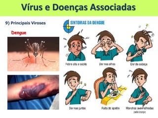Vírus e Doenças Associadas
9) Principais Viroses
Dengue
 