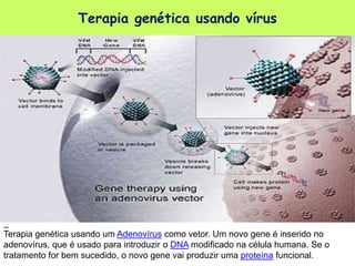 Terapia genética usando vírus
Terapia genética usando um Adenovírus como vetor. Um novo gene é inserido no
adenovírus, que é usado para introduzir o DNA modificado na célula humana. Se o
tratamento for bem sucedido, o novo gene vai produzir uma proteína funcional.
 
