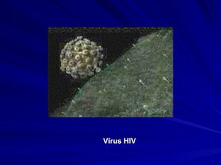 Vírus HIV
 