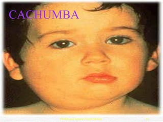 CACHUMBA




     Professora Ionara Urrutia Moura   13
 