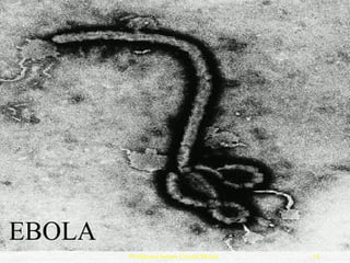 EBOLA
        Professora Ionara Urrutia Moura   14
 