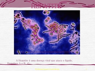 HEPATITE




        http://images.encarta.msn.com/xrefmedia/sharemed/targets/images/pho/t045/T045379A.jpg




       A Hepatite é uma doença viral que ataca o fígado.
Hepatites A e B, C

                                   Professora Ionara Urrutia Moura                              5
 
