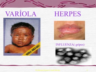 VARÍOLA                      HERPES



                               INFLUENZA( gripes)




      Professora Ionara Urrutia Moura               9
 