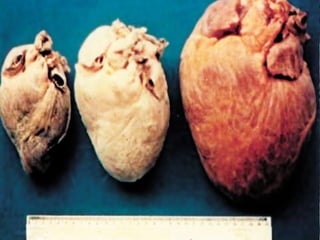 Classificação das Doenças
 Endemias  moléstias que afetam um grande
número de pessoas em uma região,
rotineiramente, como por exemplo malária,
doença de Chagas, doença do sono,
esquistossomose.
 