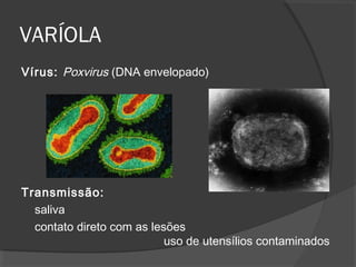 Vírus: Poxvirus (DNA envelopado)
Transmissão:
saliva
contato direto com as lesões
uso de utensílios contaminados
VARÍOLA
 