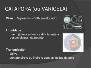CATAPORA (ou VARICELA)
Vírus: Herpesvirus (DNA envelopado)
Imunidade:
quem já teve a doença dificilmente a
desenvolverá novamente
Transmissão:
saliva
contato direto ou indireto com as lesões da pele
 