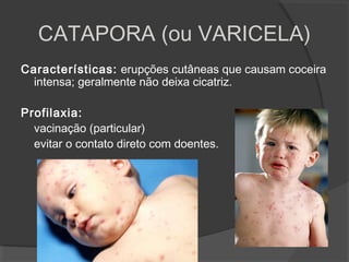 Características: erupções cutâneas que causam coceira
intensa; geralmente não deixa cicatriz.
Profilaxia:
vacinação (particular)
evitar o contato direto com doentes.
CATAPORA (ou VARICELA)
 