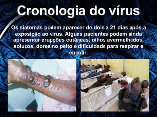 Cronologia do vírus 
Os sintomas podem aparecer de dois a 21 dias após a 
exposição ao vírus. Alguns pacientes podem ainda 
apresentar erupções cutâneas, olhos avermelhados, 
soluços, dores no peito e dificuldade para respirar e 
engolir. 
 