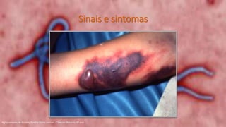 Sinais e sintomas
Agrupamento de Escolas Rainha Dona Leonor - Ciências Naturais 9º ano
 