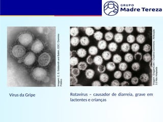 Vírus da Gripe Rotavírus – causador de diarreia, grave em
lactentes e crianças
Imagem:
C.
S.
Goldsmith
and
Balish,
CDC
/
Domínio
Público
Imagem:
GragamColm
/
Creative
Commons
-
Atribuição
3.0
Não
Adaptada
 