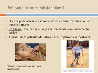 Poliomielite ou paralisia infantil 
 O vírus pode atacar o sistema nervoso e causar paralisia, ou até 
mesmo a morte. 
 Profilaxia: vacinar as crianças, ter cuidados com saneamento 
básico . 
 Transmissão: gotículas de saliva, tosse, espirro e via fecal-oral. 
Criança recebendo vacina para 
poliomielite. 
 