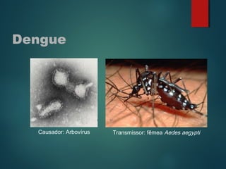 Dengue
Transmissor: fêmea Aedes aegyptiCausador: Arbovírus
 