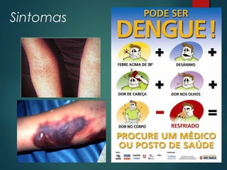 Sintomas
 