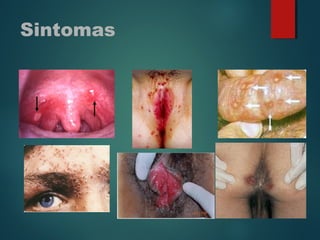 Sintomas
 
