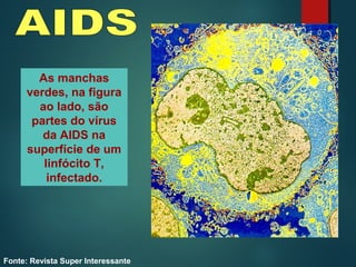 As manchas
verdes, na figura
ao lado, são
partes do vírus
da AIDS na
superfície de um
linfócito T,
infectado.
Fonte: Revista Super Interessante
 