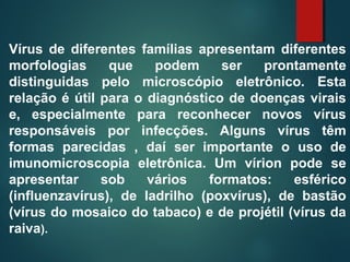 Vírus de diferentes famílias apresentam diferentes
morfologias que podem ser prontamente
distinguidas pelo microscópio eletrônico. Esta
relação é útil para o diagnóstico de doenças virais
e, especialmente para reconhecer novos vírus
responsáveis por infecções. Alguns vírus têm
formas parecidas , daí ser importante o uso de
imunomicroscopia eletrônica. Um vírion pode se
apresentar sob vários formatos: esférico
(influenzavírus), de ladrilho (poxvírus), de bastão
(vírus do mosaico do tabaco) e de projétil (vírus da
raiva).
 